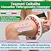 TESMED Cellulite Massagegerät, Klinisch Nachgewiesene Wirksamkeit, Made in Italy, Anti Cellulite Massagegerät mit Rollen, welche die Haut heben, straffen und glätten. Patentiert (Rose) - 2